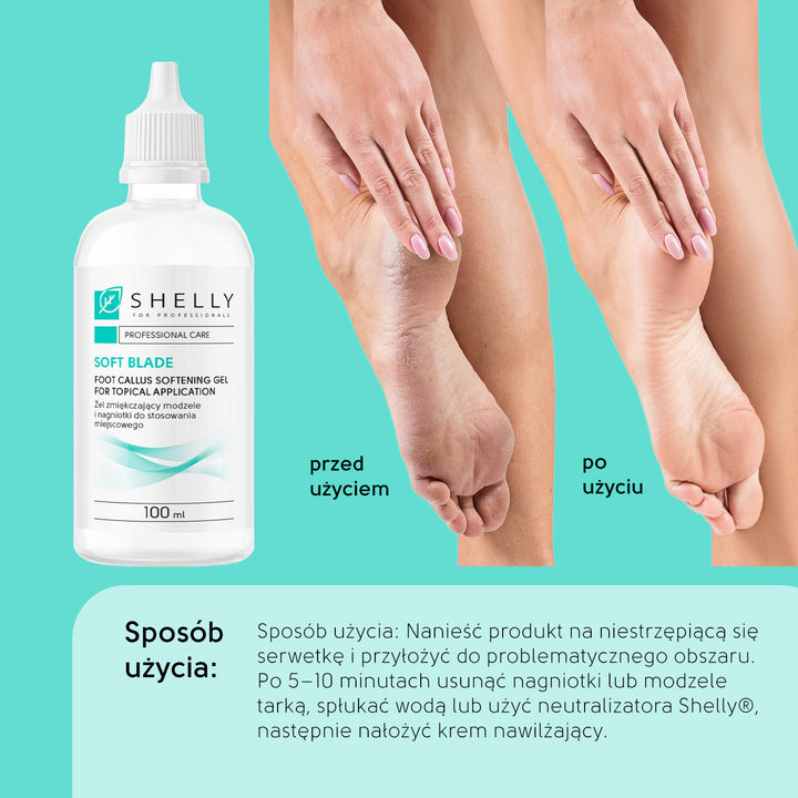 Foot Callus Softening Gel For Topical Application Soft Blade - 100 ml