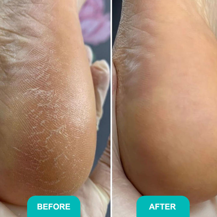 Foam express softener for pedicure Soft blade - 150 ml