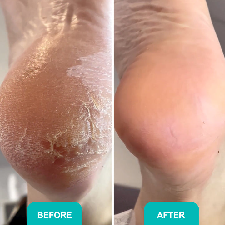 Foam express softener for pedicure Soft blade - 150 ml