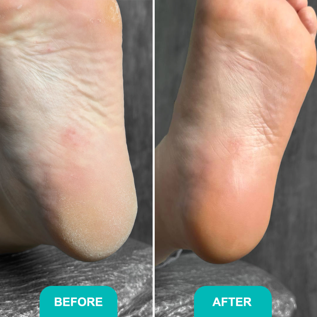 Foam express softener for pedicure Soft blade - 150 ml