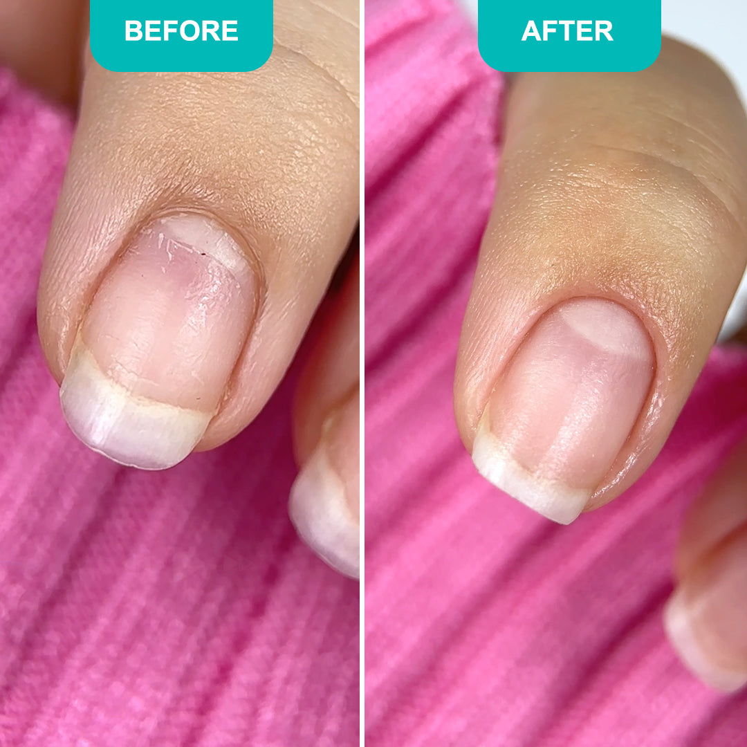 Strengthening nail balm with bisabolol and eucalyptus - 15 ml